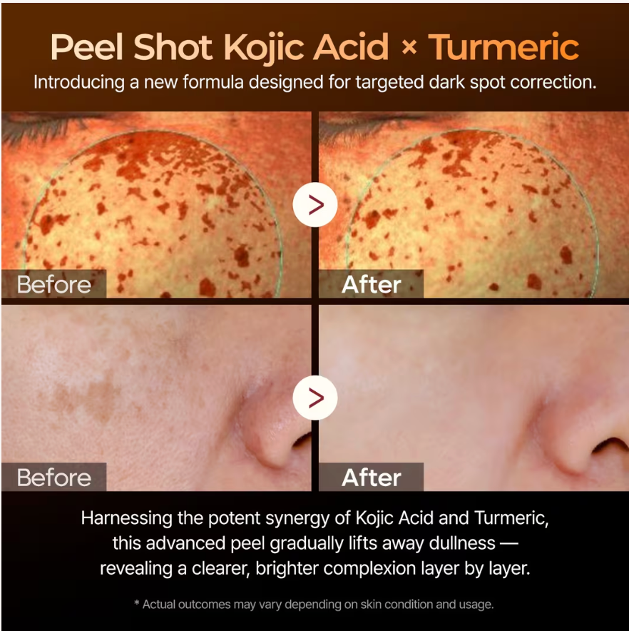 Dr. Melaxin Peel Shot Kojic Acid Turmeric Serum 80ml