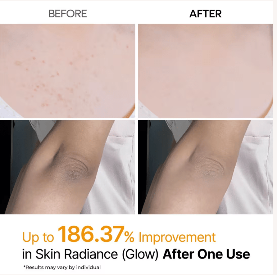 Dr. Melaxin Peel Shot Exfoliating Kojic Acid Turmeric Spray 200ml - BeautyVaultz